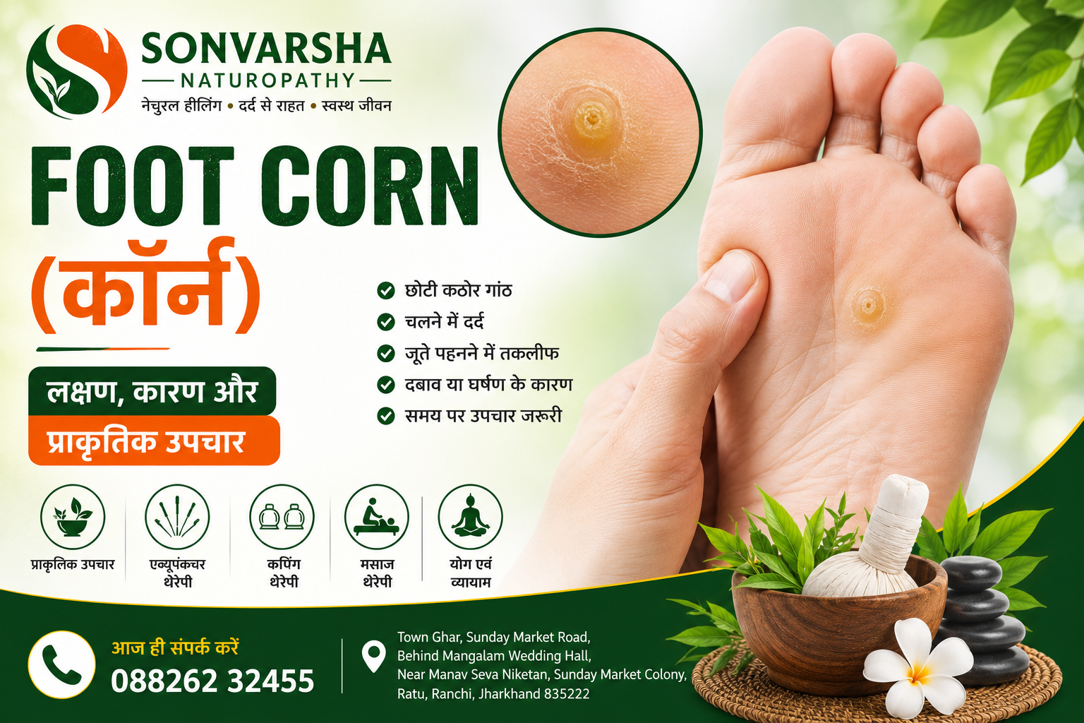 Foot corn treatment with natural healing